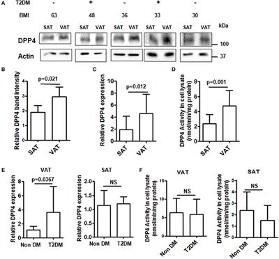 Increased Plasma Dipeptidyl Peptidase-4 (DPP4) Activity Is an Obesity-Independent Parameter for Glycemic Deregulation in Type 2 Diabetes Patients